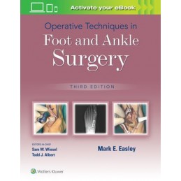 Operative Techniques in Foot and Ankle Surgery