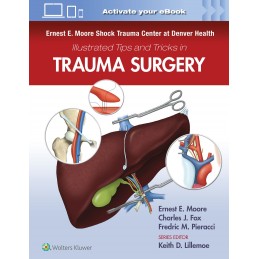 Ernest E. Moore Shock Trauma Center at Denver Health Illustrated Tips and Tricks in Trauma Surgery