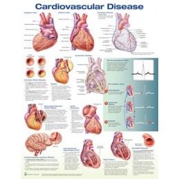 Cardiovascular Disease Anatomical Chart