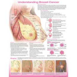 Understanding Breast Cancer Anatomical Chart