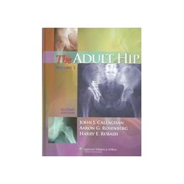 The Adult Hip