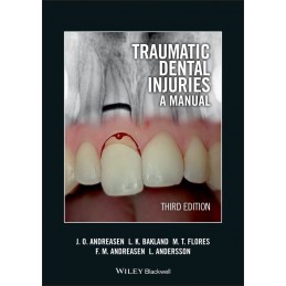 Traumatic Dental Injuries:...