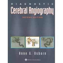 Diagnostic Cerebral...