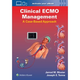 Clinical ECMO Management: A...