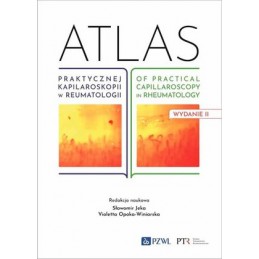 Atlas praktycznej kapilaroskopii w reumatologii. Atlas of practical capillaroscopy in rheumatology.