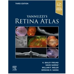Yannuzzi's Retina Atlas