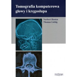Tomografia komputerowa...