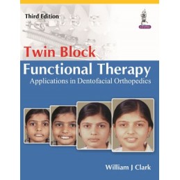 Twin Block Functional Therapy