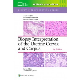 Biopsy Interpretation of the Uterine Cervix and Corpus: Print + digital version with Multimedia