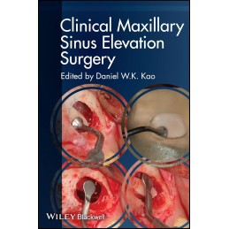 Clinical Maxillary Sinus...