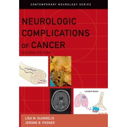 Neurologic Complications of...