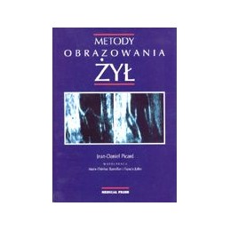 Metody obrazowania żył