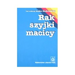 Rak szyjki macicy