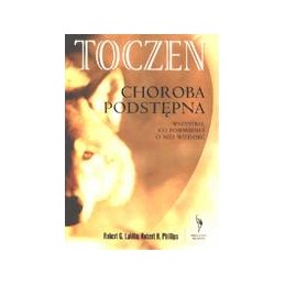 Toczeń. Choroba podstępna