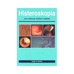 Histeroskopia