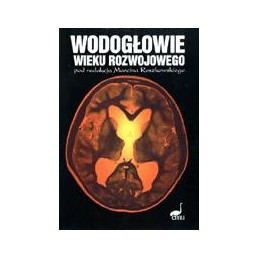Wodogłowie wieku rozwojowego