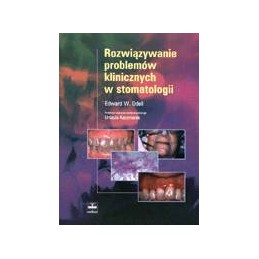Rozwiązywanie problemów...