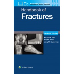 Handbook of Fractures: Print + digital version with Multimedia