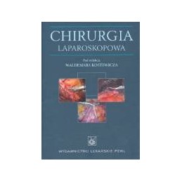 Chirurgia laparoskopowa