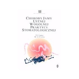 Choroby jamy ustnej w...