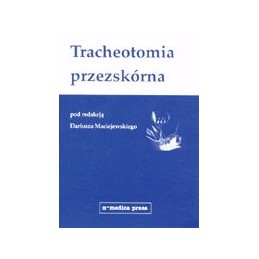 Tracheotomia przezskórna