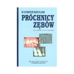 Kompendium próchnicy zębów