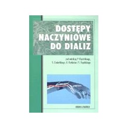 Dostępy naczyniowe do dializ