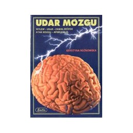 Udar mózgu