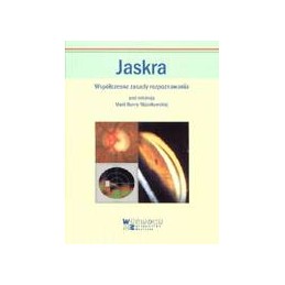 Jaskra. Współczesne zasady...