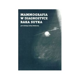 Mammografia w diagnostyce...