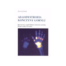 Algodystrofia kończyny górnej