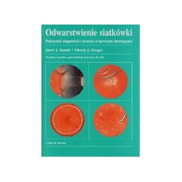 Odwarstwienie siatkówki....
