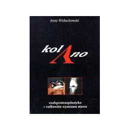 Kolano. Endoprotezoplastyka...