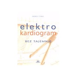 Elektrokardiogram bez tajemnic