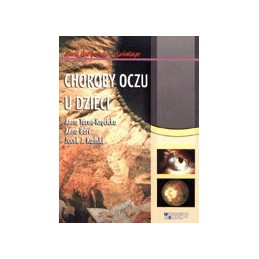 Choroby oczu u dzieci