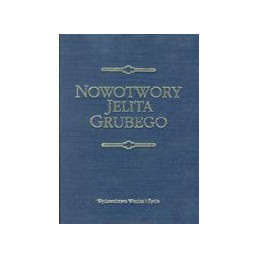 Nowotwory jelita grubego