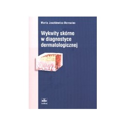 Wykwity skórne w...