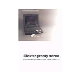 Elektrokardiogramy serca