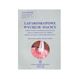 Laparoskopowe wycięcie macicy