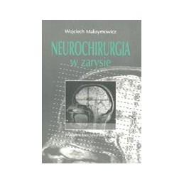 Neurochirurgia w zarysie