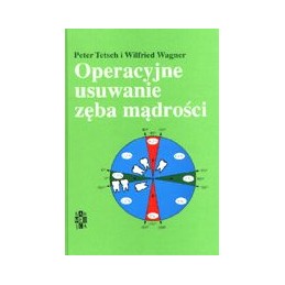 Operacyjne usuwanie zęba...
