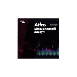 Atlas ultrasonografii naczyń