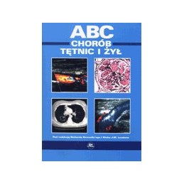 ABC chorób tętnic i żył