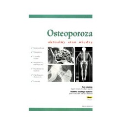 Osteoporoza. Aktualny stan...