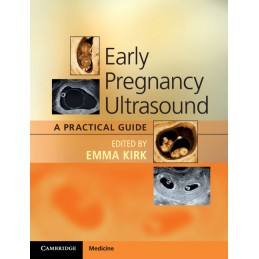 Early Pregnancy Ultrasound:...