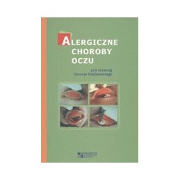 Alergiczne choroby oczu