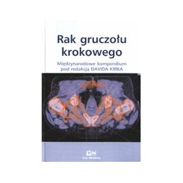 Rak gruczołu krokowego