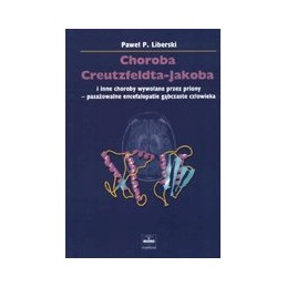 Choroba Creutzfeldta-Jakoba...