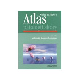 Atlas patologii skóry