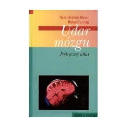 Udar mózgu - podręczny atlas